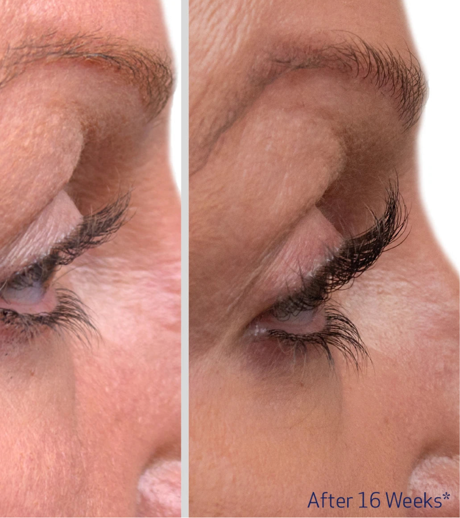 Obagi Nu Cil Eyelash Serum