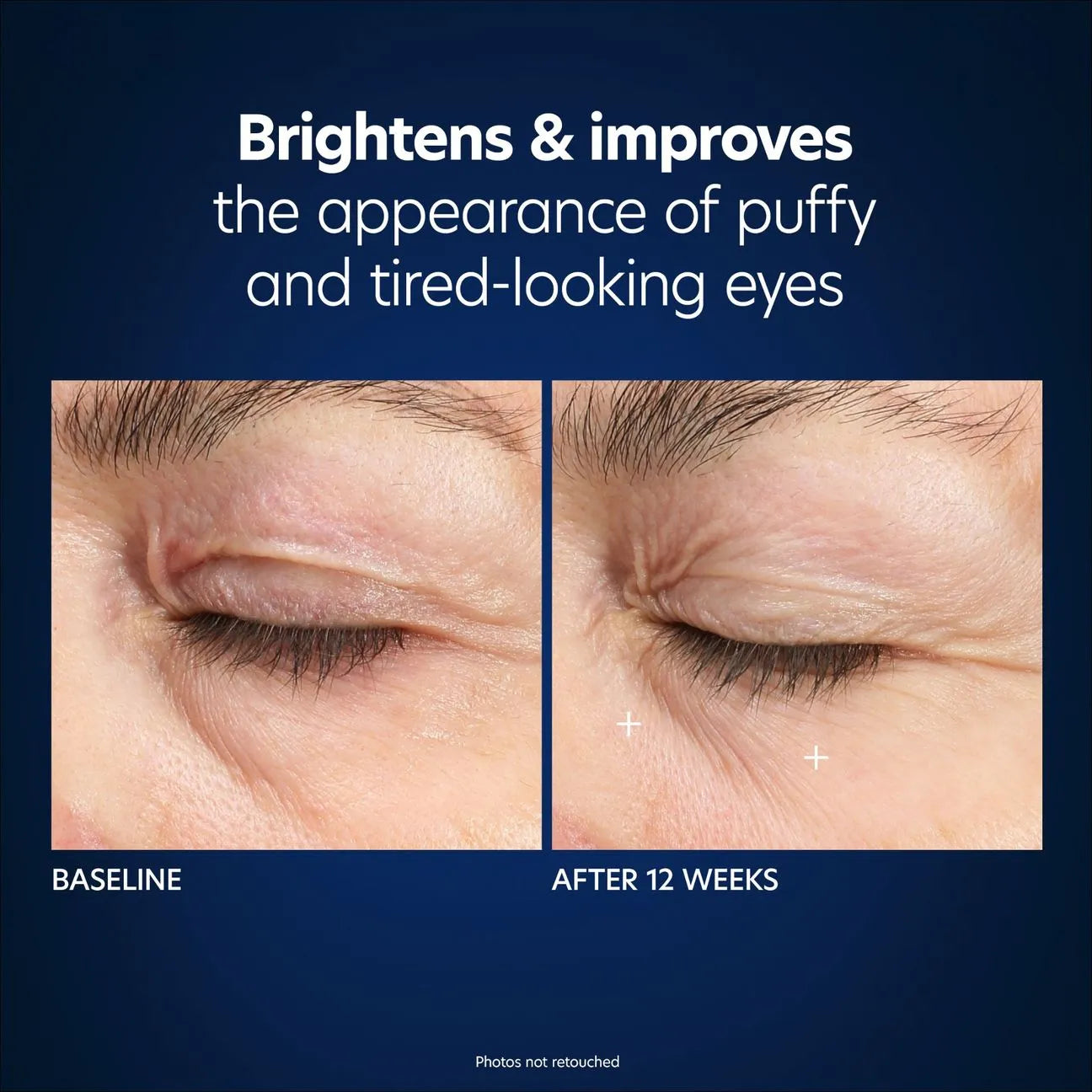 Microneedling Eye Patch