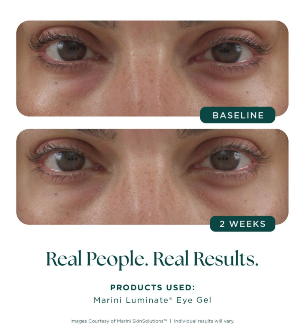 Marini Luminate® Eye Gel