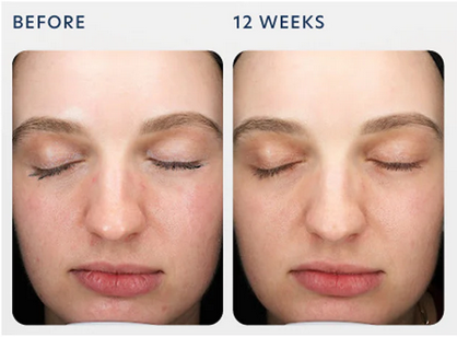 Triple Exfoliation Peel Pads