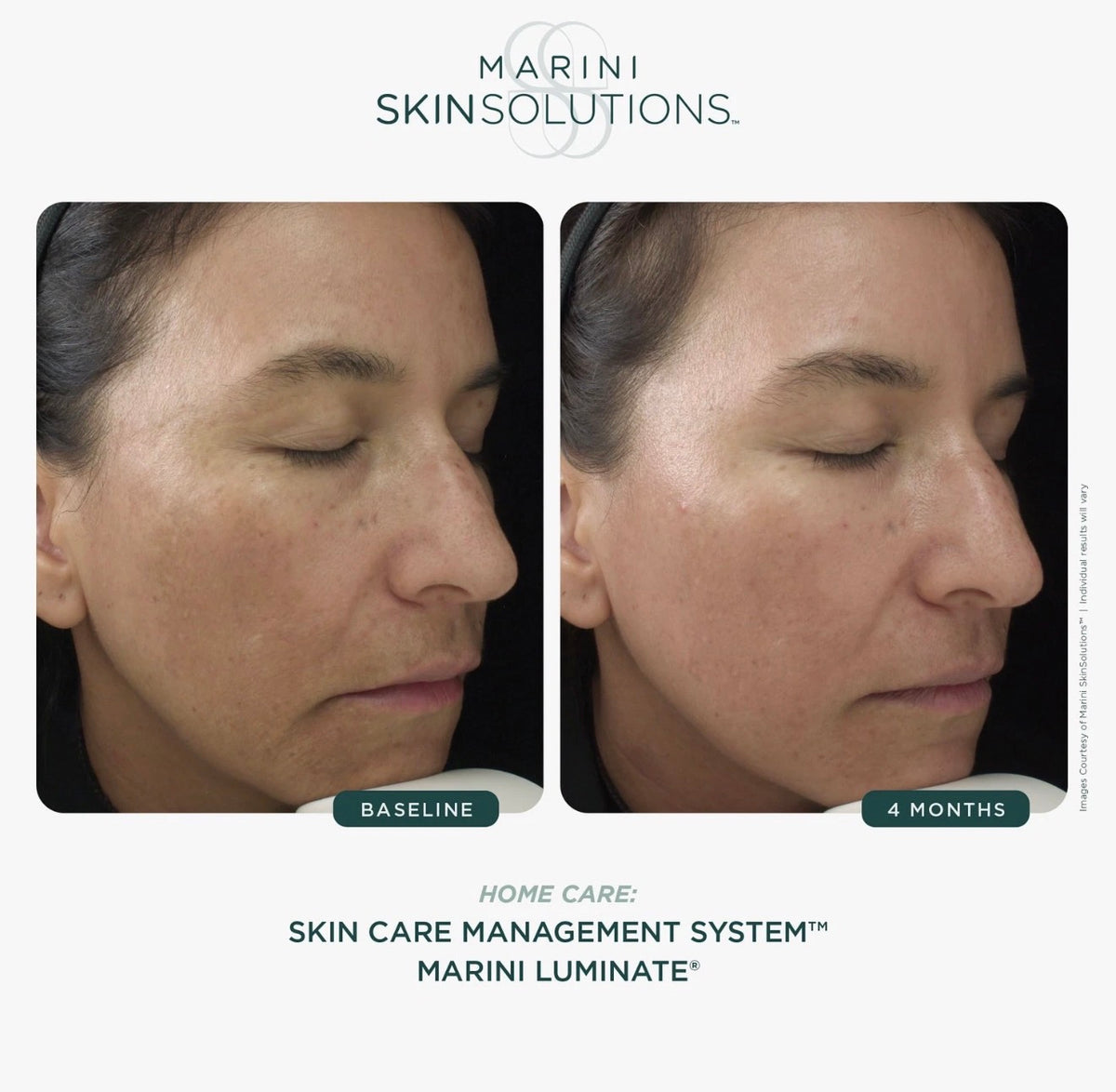 Marini Luminate® Face Lotion