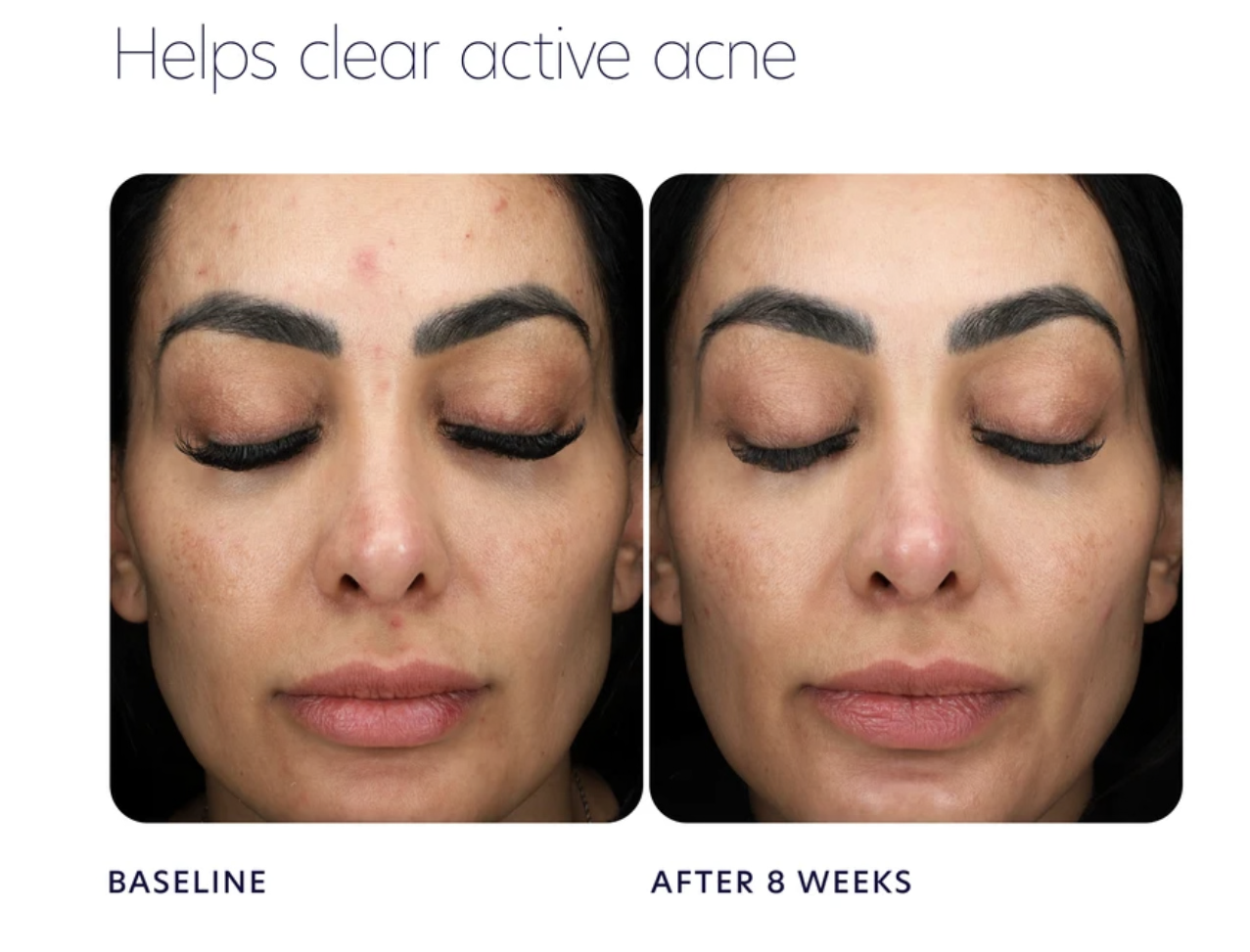Triple Exfoliation Peel Pads
