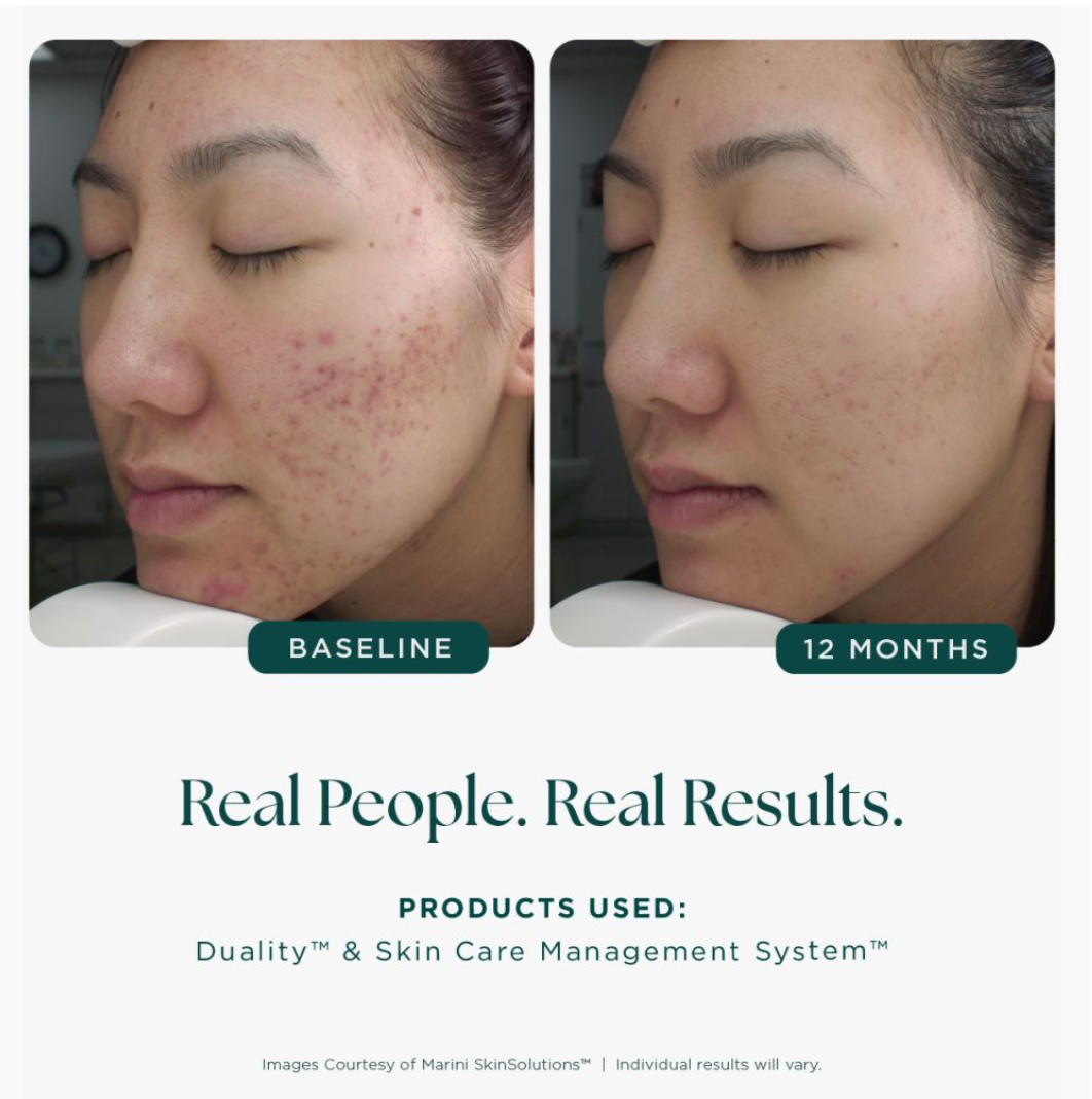 Age Intervention® Duality™