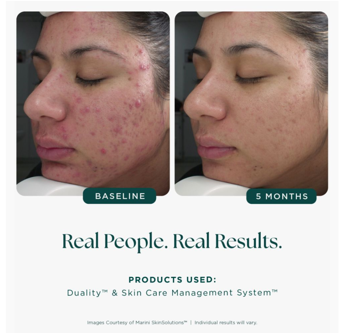 Age Intervention® Duality™