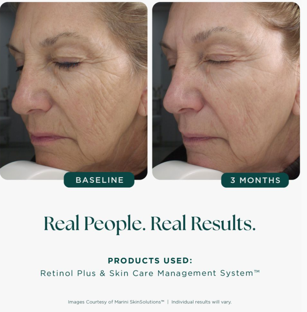 Jan Marini Age Intervention Retinol Plus