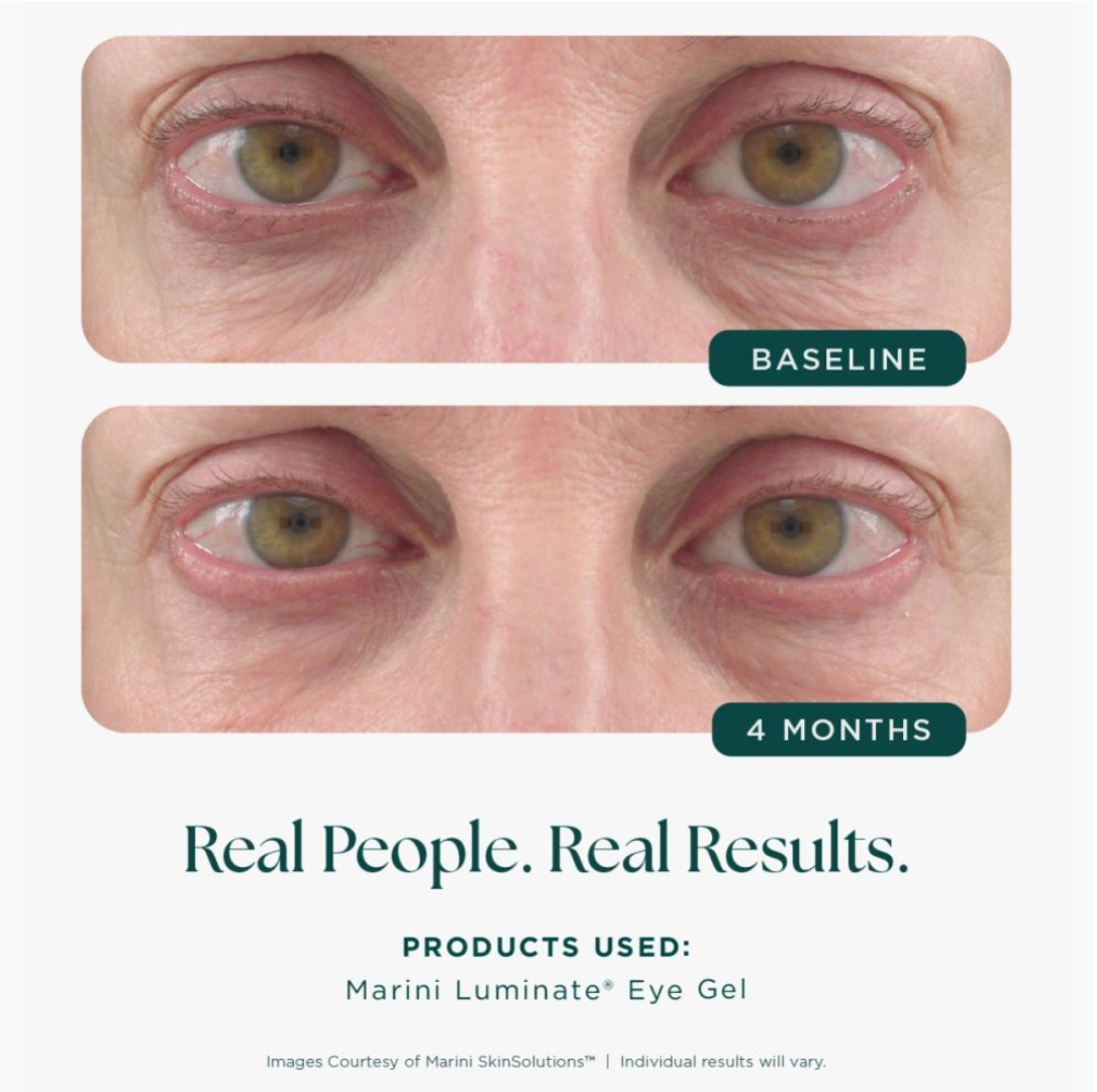 Marini Luminate® Eye Gel